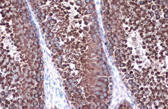 HSP90 alpha Antibody in Immunohistochemistry (Paraffin) (IHC (P))