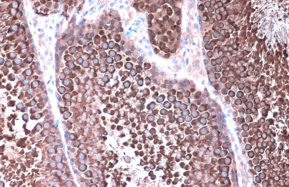 HSP90 alpha Antibody in Immunohistochemistry (Paraffin) (IHC (P))