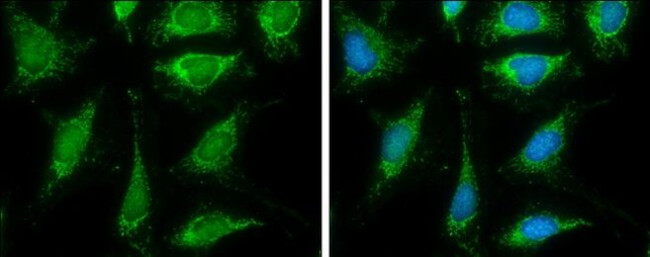 DLAT Antibody in Immunocytochemistry (ICC/IF)