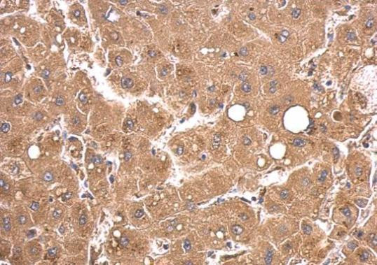 PEX5 Antibody in Immunohistochemistry (Paraffin) (IHC (P))