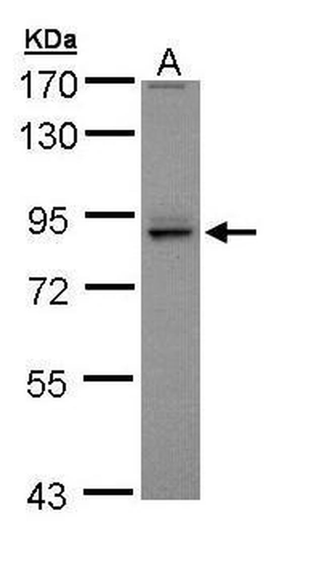 PEX5 Antibody in Western Blot (WB)