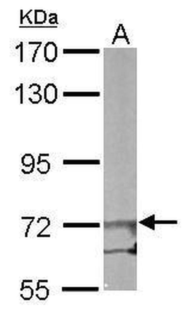 eIF2b epsilon Antibody in Western Blot (WB)