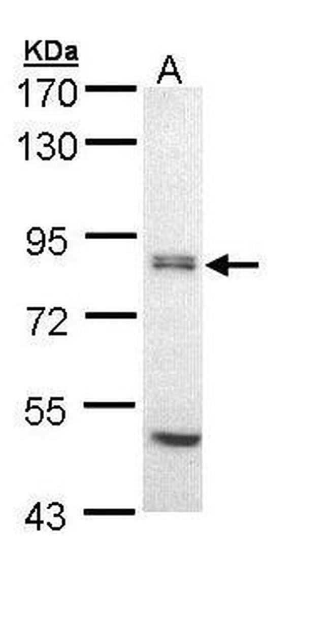 eIF2b epsilon Antibody in Western Blot (WB)