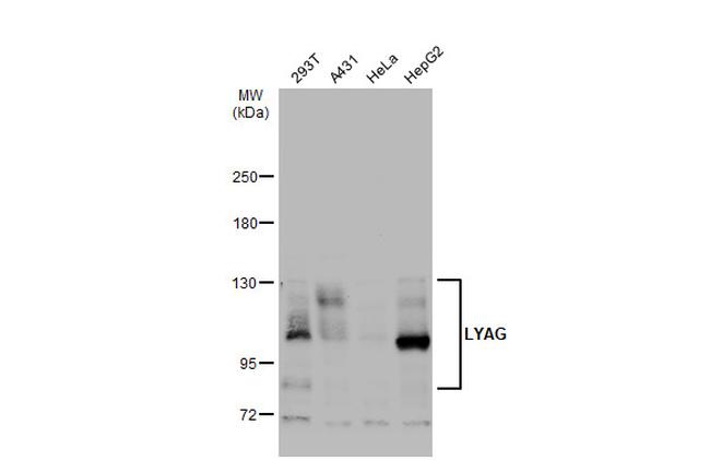 LYAG Antibody in Western Blot (WB)