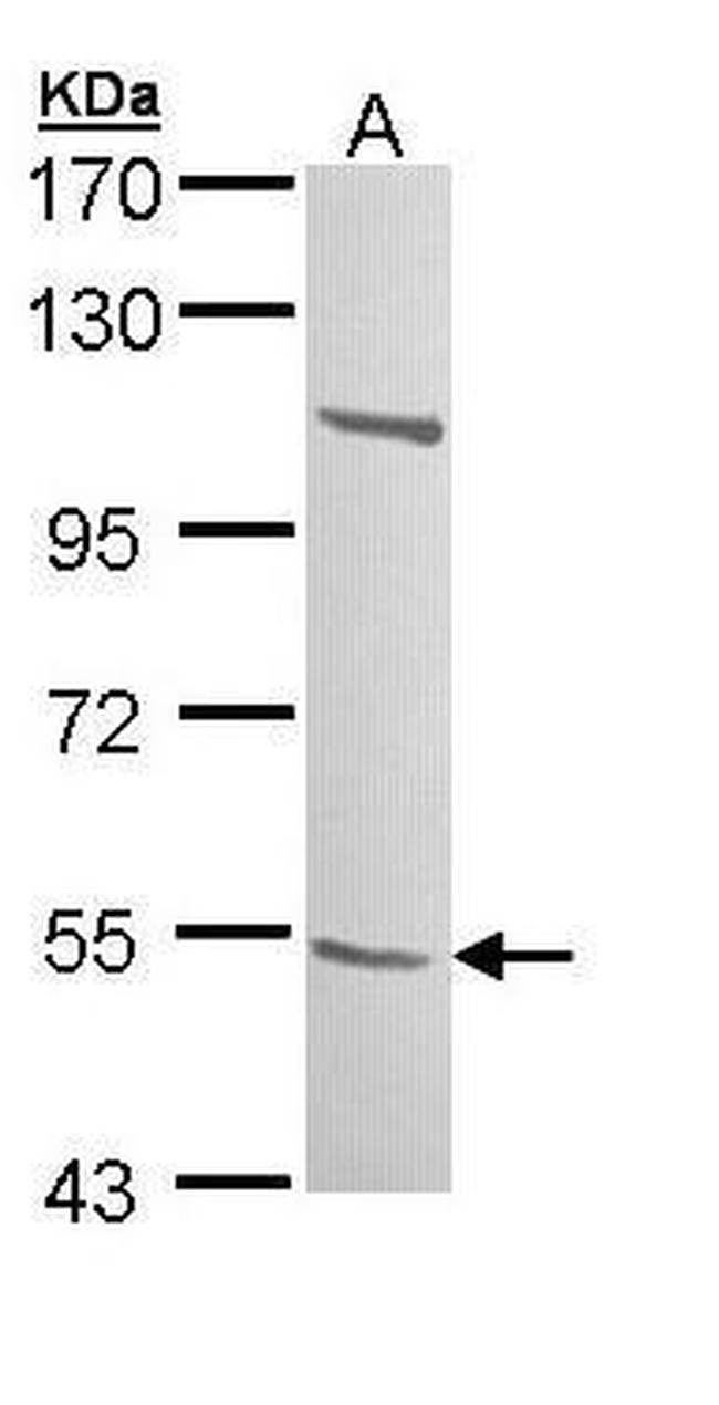 B3GALTL Antibody in Western Blot (WB)