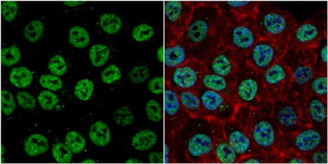 EXO1 Antibody in Immunocytochemistry (ICC/IF)