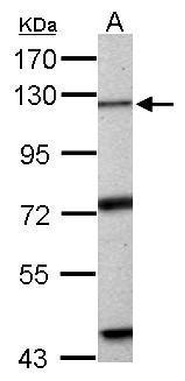 EXO1 Antibody in Western Blot (WB)