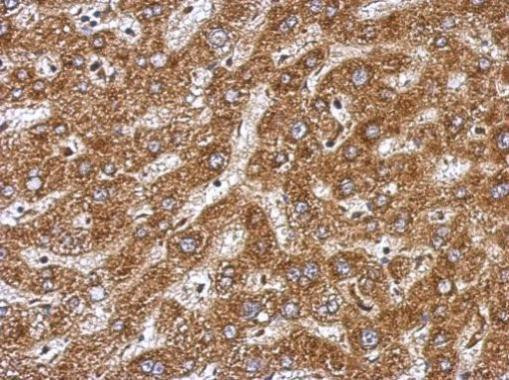 BAAT Antibody in Immunohistochemistry (Paraffin) (IHC (P))