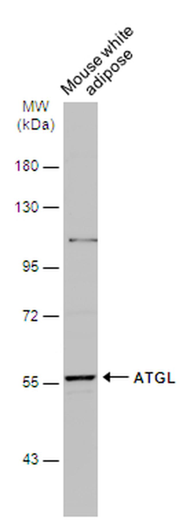 ATGL Antibody in Western Blot (WB)