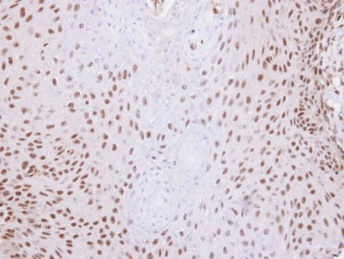 SNW1 Antibody in Immunohistochemistry (Paraffin) (IHC (P))