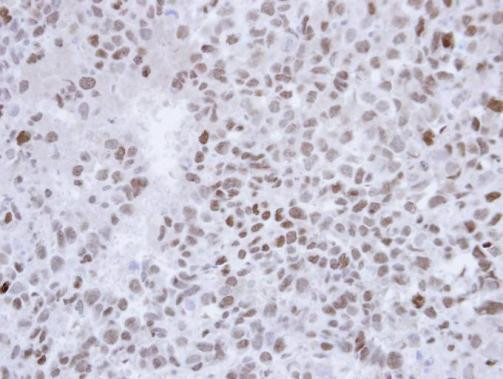 SALL4 Antibody in Immunohistochemistry (Paraffin) (IHC (P))