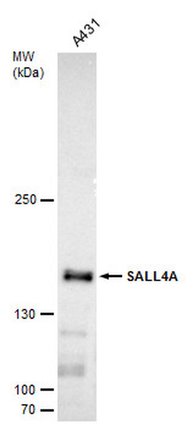 SALL4 Antibody in Western Blot (WB)