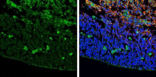 ZIC3 Antibody in Immunohistochemistry (Frozen) (IHC (F))