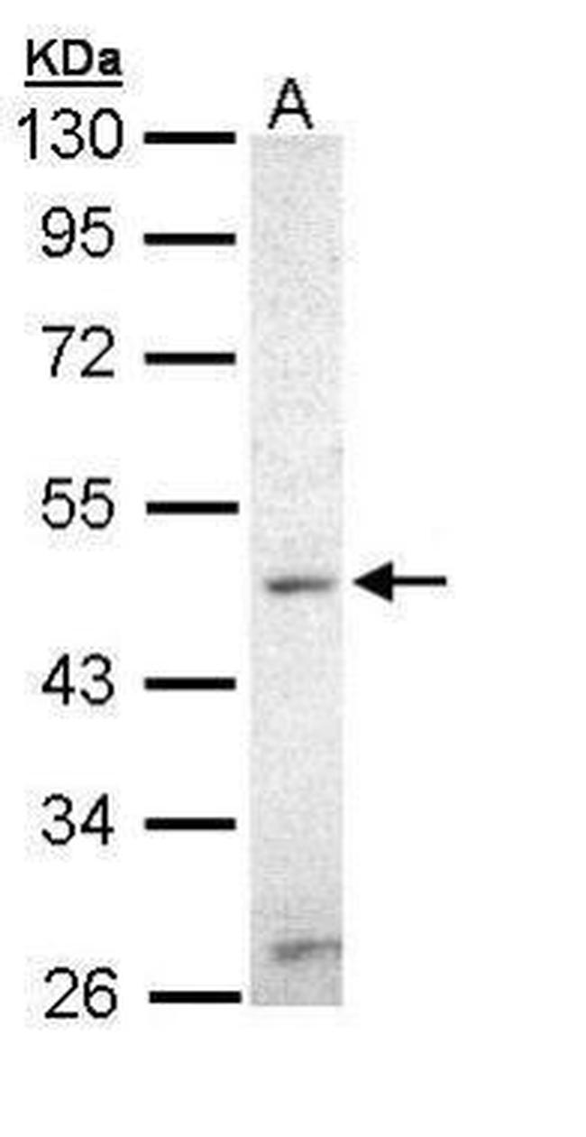 ZIC3 Antibody in Western Blot (WB)