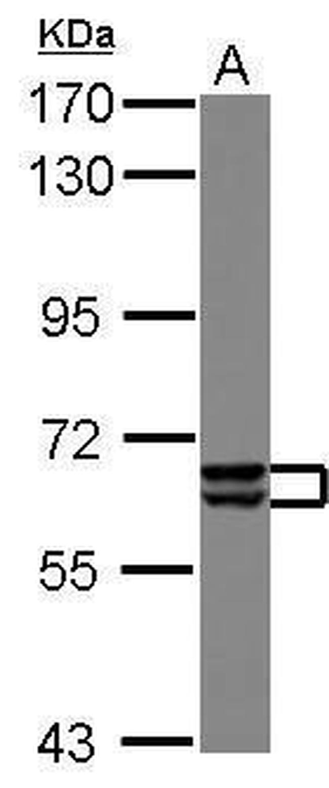 PAK3 Antibody in Western Blot (WB)