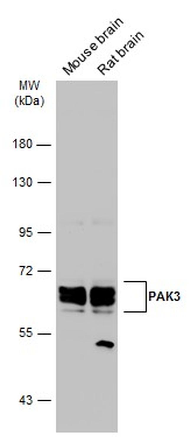 PAK3 Antibody in Western Blot (WB)