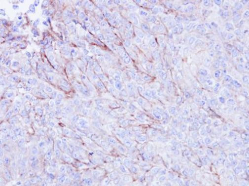 CDKAL1 Antibody in Immunohistochemistry (Paraffin) (IHC (P))