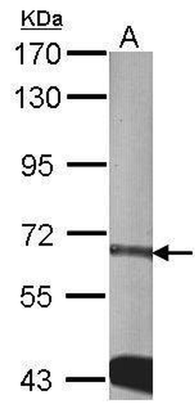 CDKAL1 Antibody in Western Blot (WB)