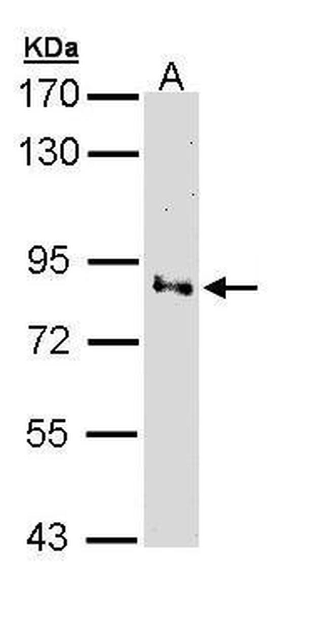 Villin Antibody in Western Blot (WB)