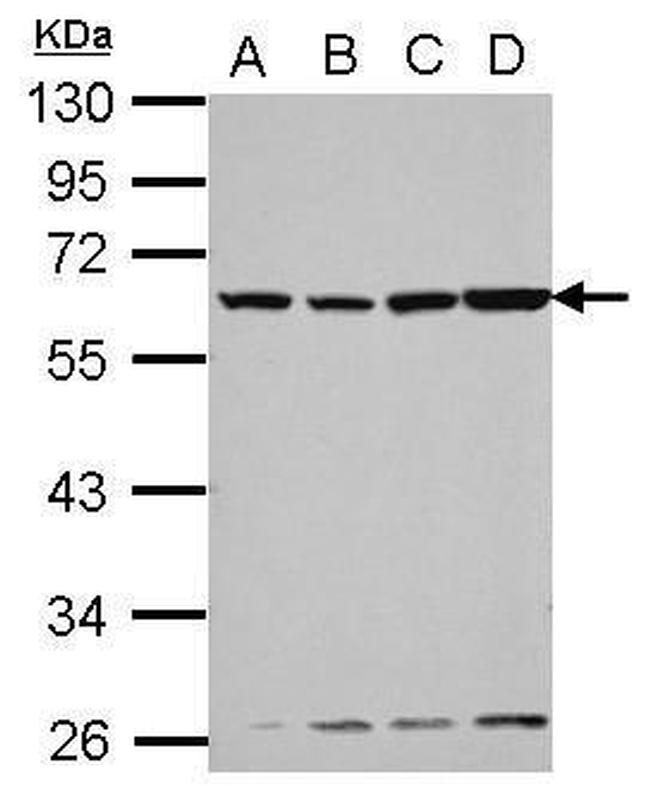 GC Antibody in Western Blot (WB)