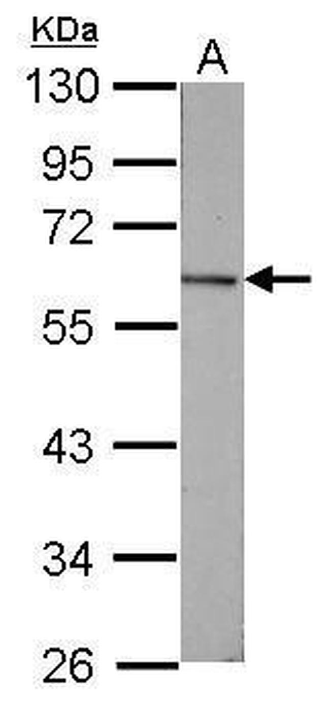 GC Antibody in Western Blot (WB)