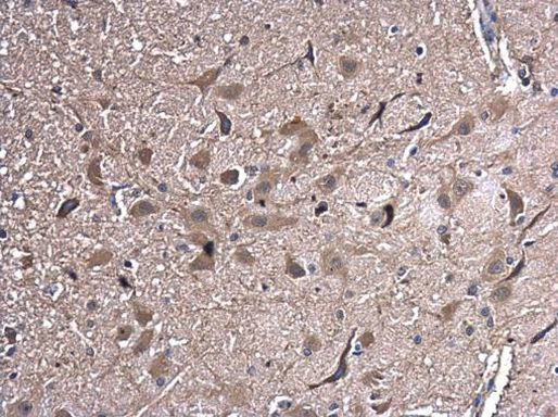 HSPA2 Antibody in Immunohistochemistry (Paraffin) (IHC (P))