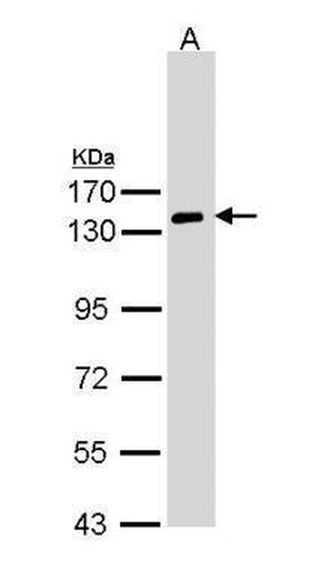 NPR1 Antibody in Western Blot (WB)