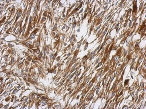 PKC theta Antibody in Immunohistochemistry (Paraffin) (IHC (P))