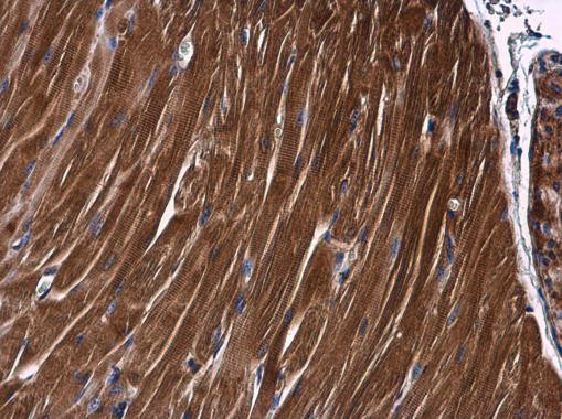 PKC theta Antibody in Immunohistochemistry (Paraffin) (IHC (P))