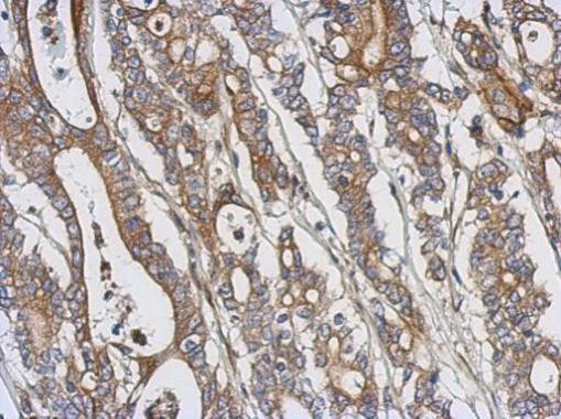 PKC theta Antibody in Immunohistochemistry (Paraffin) (IHC (P))