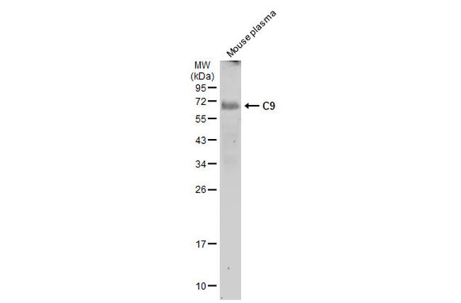 Complement C9 Antibody in Western Blot (WB)