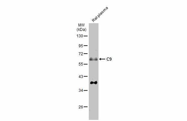 Complement C9 Antibody in Western Blot (WB)