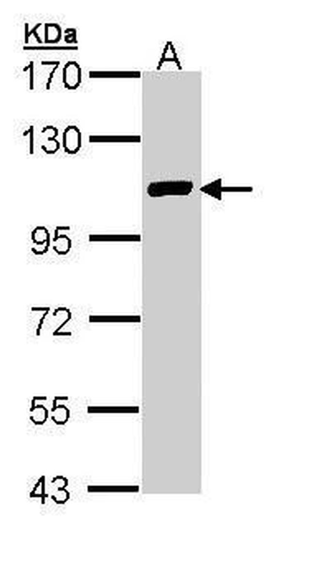 ZFPM2 Antibody in Western Blot (WB)