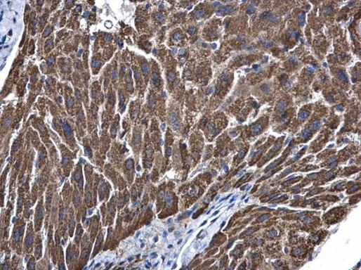 ALDH5A1 Antibody in Immunohistochemistry (Paraffin) (IHC (P))