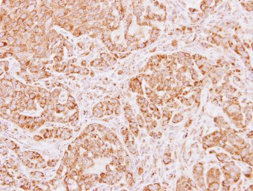 ALDH5A1 Antibody in Immunohistochemistry (Paraffin) (IHC (P))