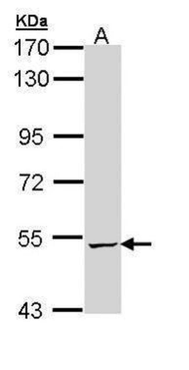 ALDH5A1 Antibody in Western Blot (WB)