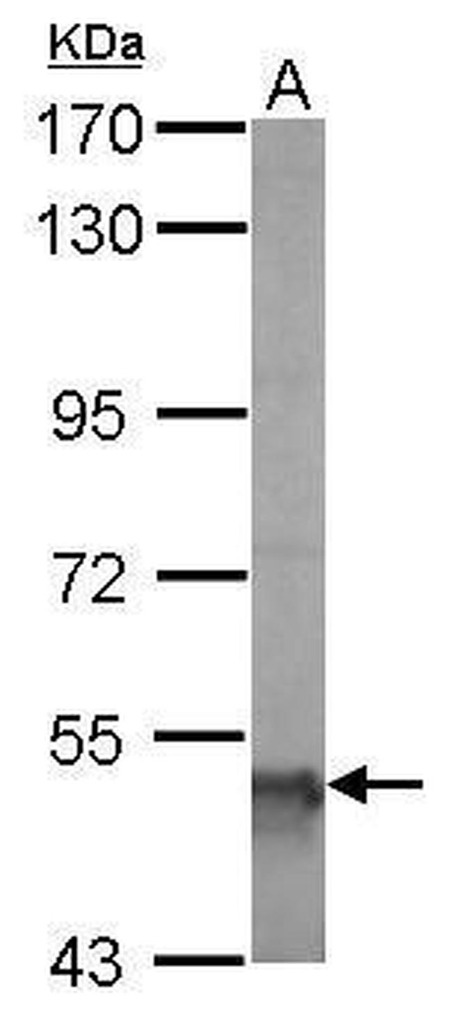 ALDH5A1 Antibody in Western Blot (WB)