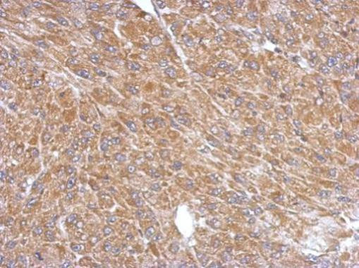 PLA2G4A Antibody in Immunohistochemistry (Paraffin) (IHC (P))