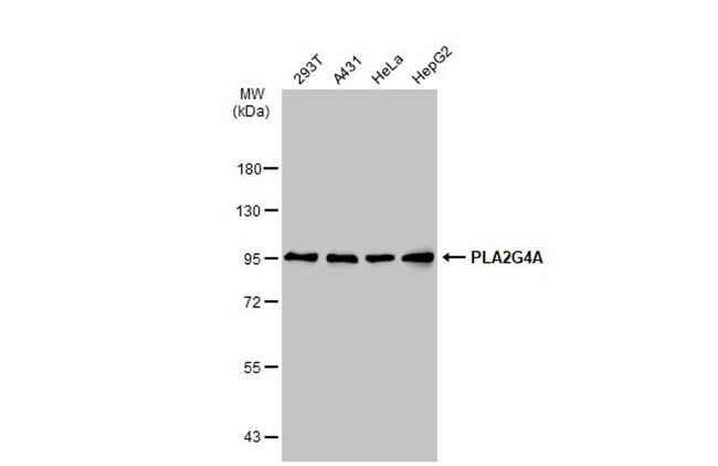 PLA2G4A Antibody in Western Blot (WB)