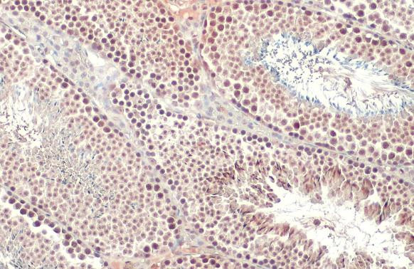 SETDB1 Antibody in Immunohistochemistry (Paraffin) (IHC (P))