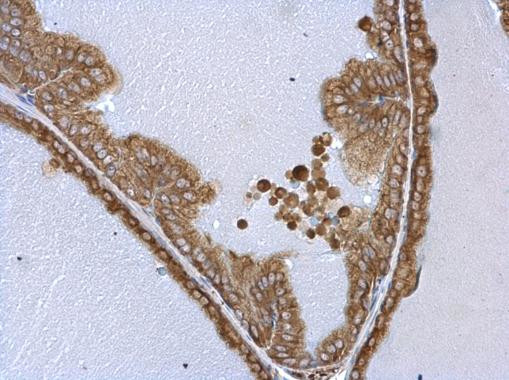 WARS Antibody in Immunohistochemistry (Paraffin) (IHC (P))