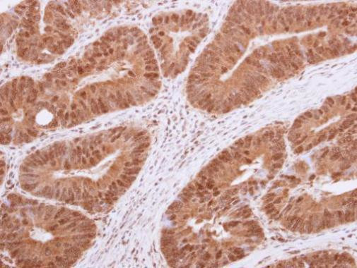 HDAC4 Antibody in Immunohistochemistry (Paraffin) (IHC (P))