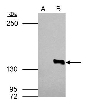 HDAC4 Antibody in Immunoprecipitation (IP)