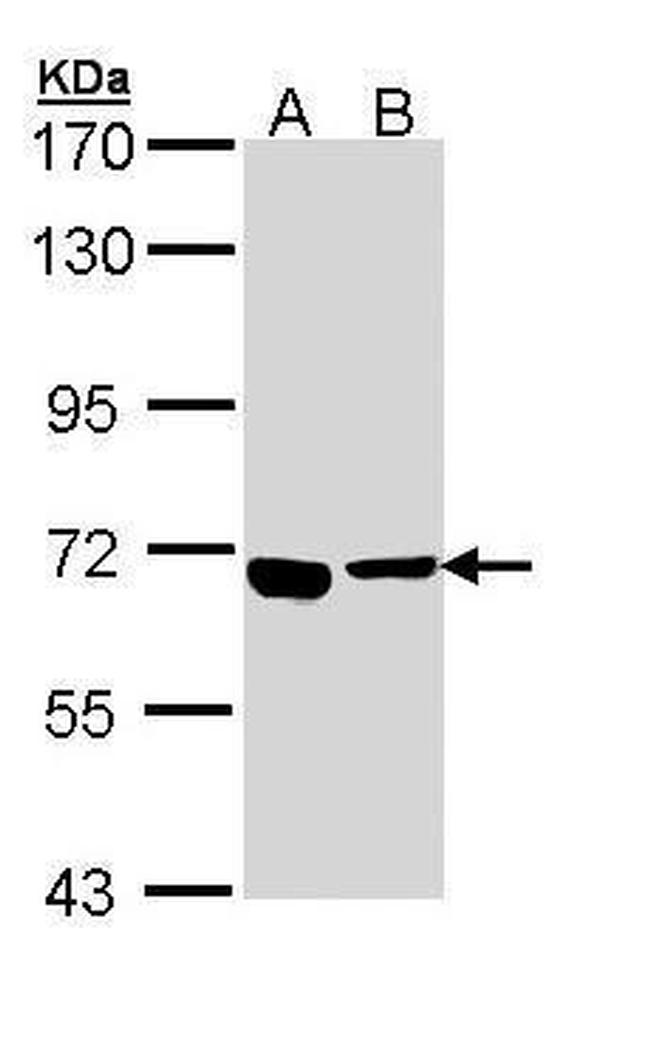 ATP6V0A4 Antibody in Western Blot (WB)