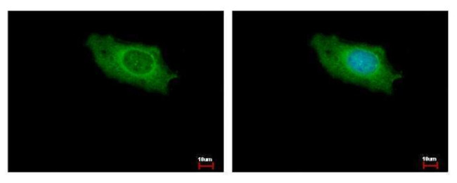 IKAP Antibody in Immunocytochemistry (ICC/IF)