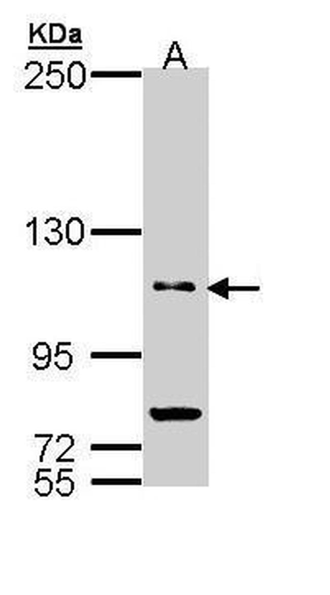 PDE11A Antibody in Western Blot (WB)