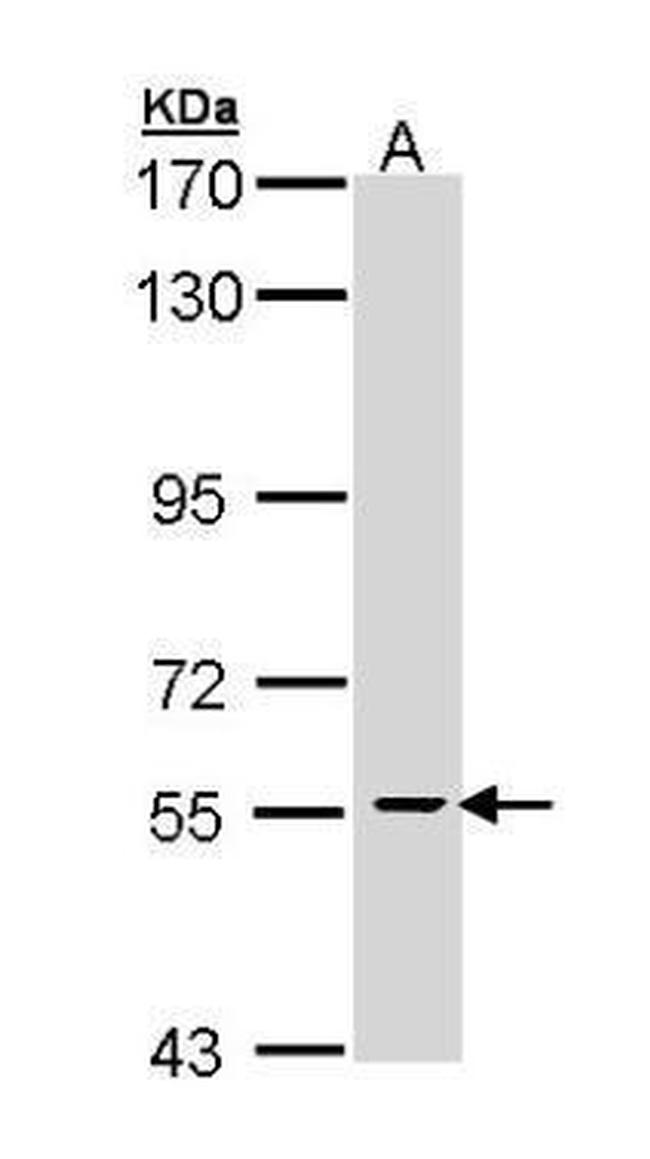 Cdc73 Antibody in Western Blot (WB)