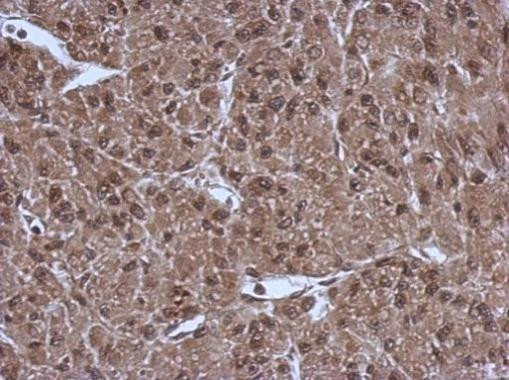 PSMC3 Antibody in Immunohistochemistry (Paraffin) (IHC (P))