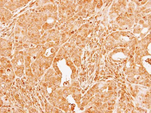 Factor X/Xa Antibody in Immunohistochemistry (Paraffin) (IHC (P))