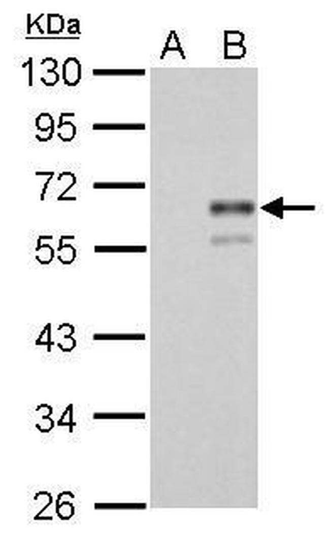 Factor X/Xa Antibody in Western Blot (WB)